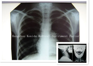 Gesundheits-Darstellungs-Röntgenfilm Digital-medizinischer X Ray trockener Film-14 x 17inch